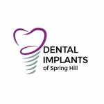 dentalimplantsspringhill